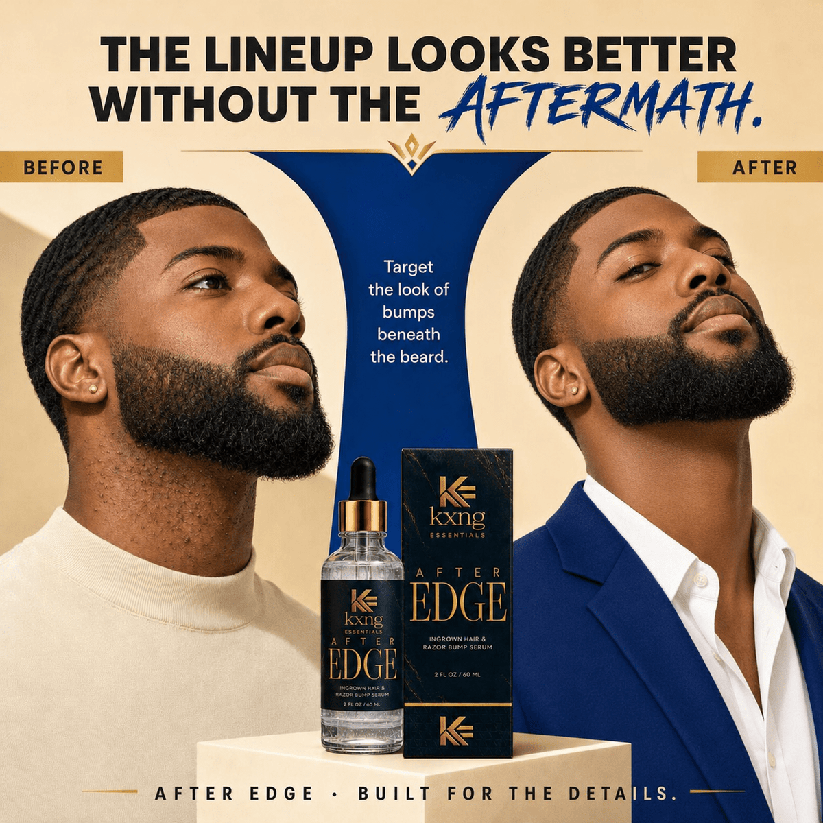 After Edge — Ingrown Hair and Razor Bump Serum That Actually Works - KXNG Cosmetics