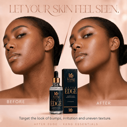 After Edge — Ingrown Hair and Razor Bump Serum That Actually Works - KXNG Cosmetics