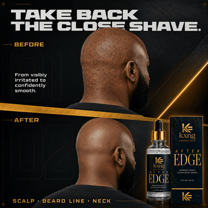 After Edge — Ingrown Hair and Razor Bump Serum That Actually Works - KXNG Cosmetics